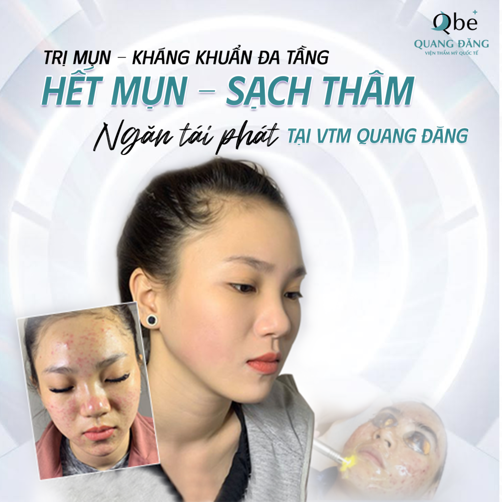 Phục Hồi Da Tổn Thương