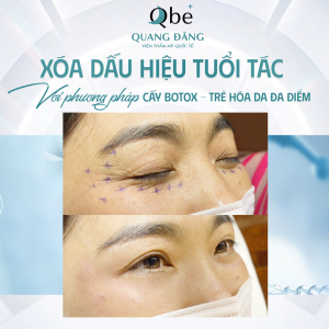 5 bước skincare sáng cho da khỏe mùa hè