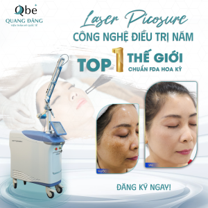 Trị nám mùa hè: Những điều cần lưu ý