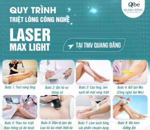 Triệt lông vĩnh viễn: So sánh IPL và Laser